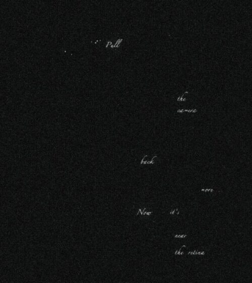 Pull the camera back more…Now it’s near the retina