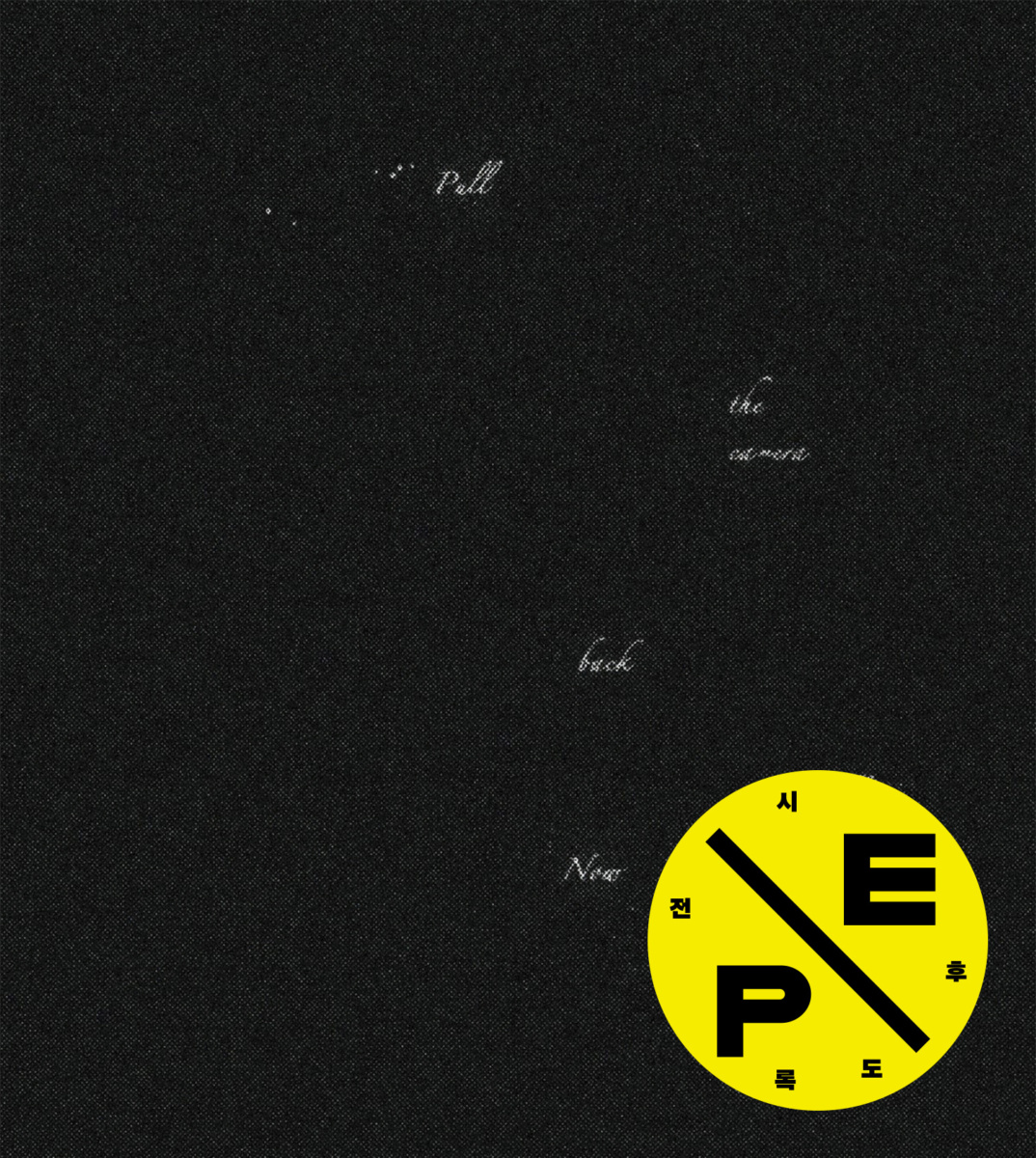 Pull the camera back more…Now it’s near the retina